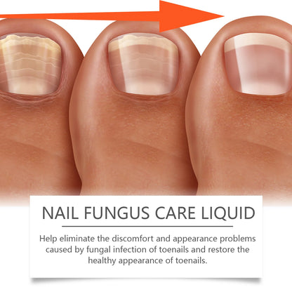 ClearNail™ Repair Serum
