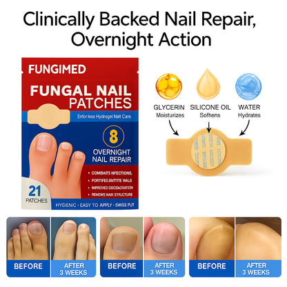 ClearNail™ Patches